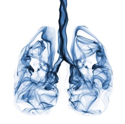 Lung Cancer caused by Radon